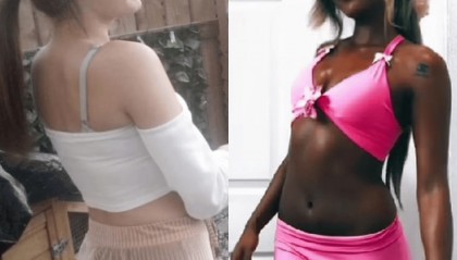 英国18岁少女日光浴成瘾，几乎每天晒，有皮肤癌风险仍停不下来